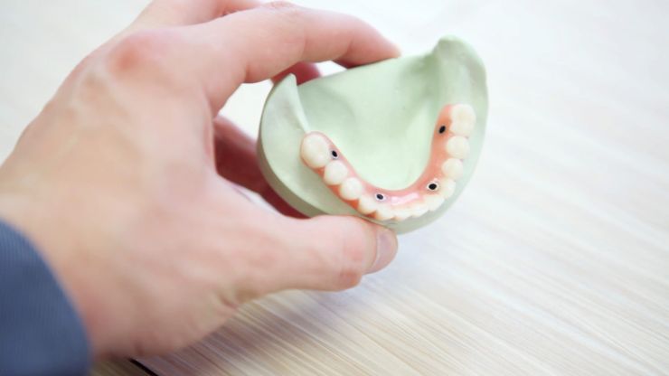 zahn implantat